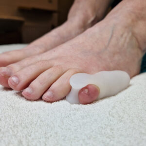 Pedisil Gel - Teenspreider / Bunionette